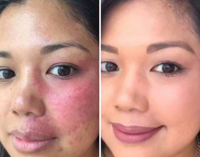 Before & After